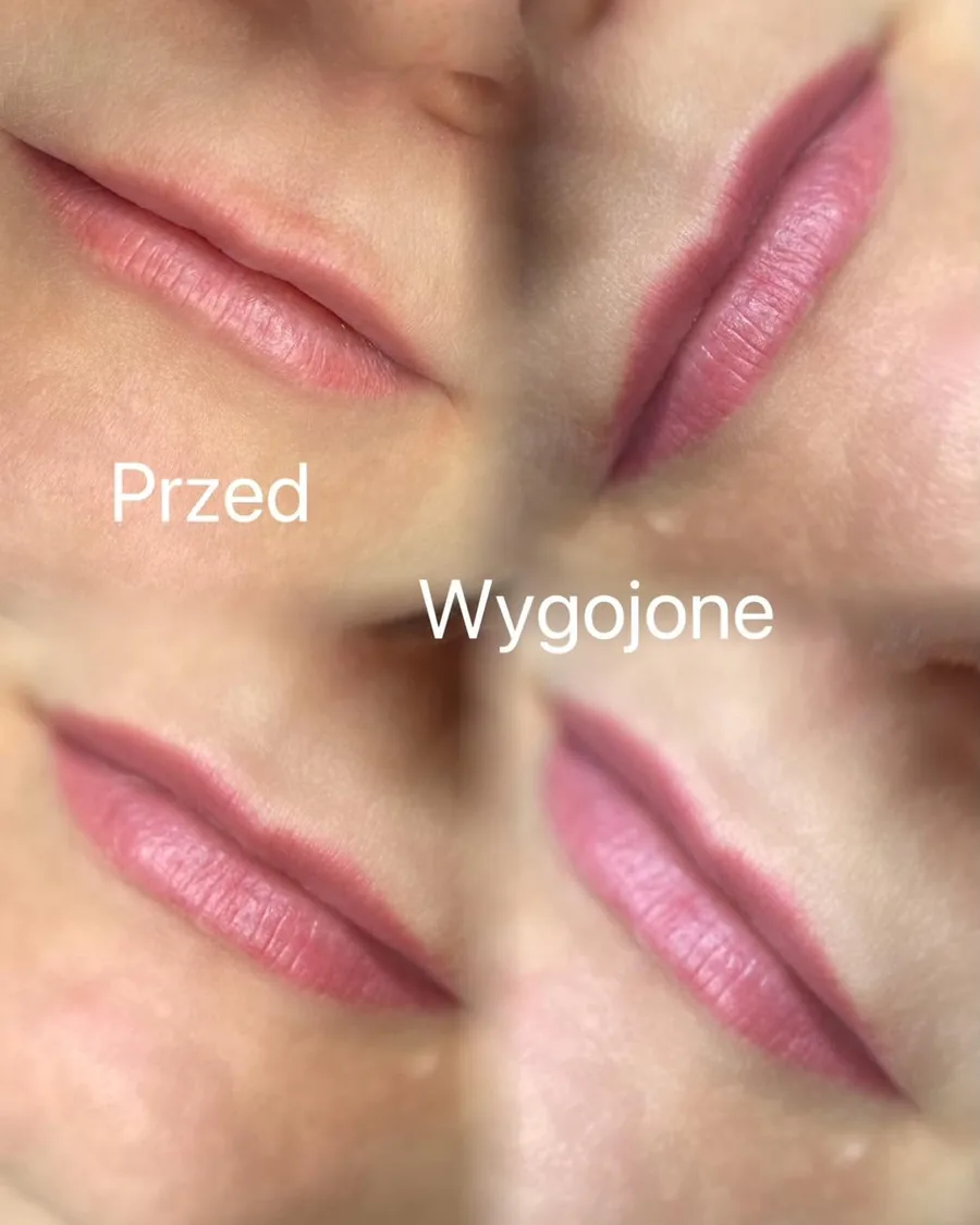 Odświeżenie makijażu permanentnego ust, porównanie przed i po wygojeniu